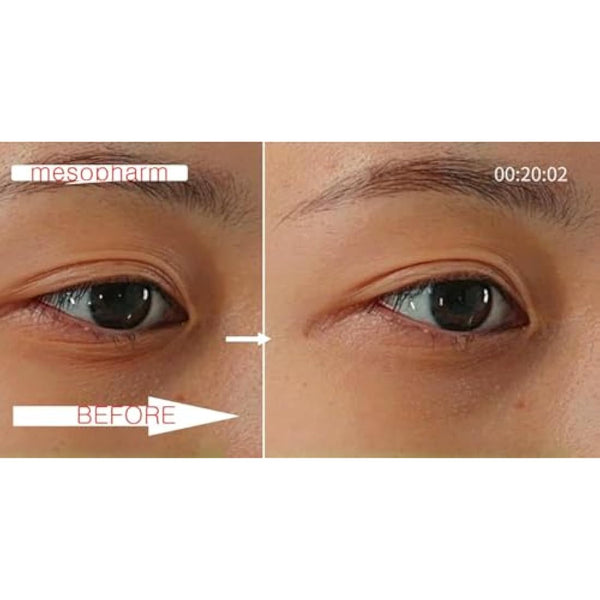 WHITESILK (4%) PDRN & (6%) Proteoglycan Complex Skin Healer Serum┃Anti-Aging, Repair, Lifting, Moisturizing (30ml)