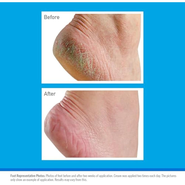 O’Keeffe’s® Jar Healthy Feet 180g (8 Pack)