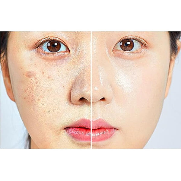 WHITESILK ULTIMATE 0.4% Retinoid Liposome Cream: Unique Line Lifting & Rejuvenation Concentrate (30ml) [K-Beauty]