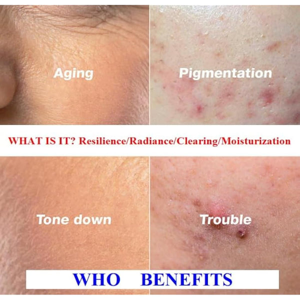 WHITESILK (4%) PDRN & (6%) Proteoglycan Complex Skin Healer Serum┃Anti-Aging, Repair, Lifting, Moisturizing (30ml)