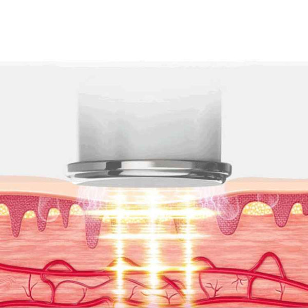 Pulse Multifunctional Hot Compress Physiotherapy Shoulder and Neck Cervical Massager Neck Protector, Style:Two Ends(White)